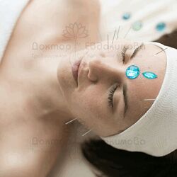 Ольга Евдокимова Акупунктурный лифтинг лица