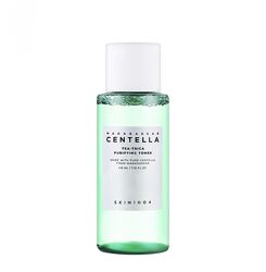 Тонер для жирной и подверженной акне кожи SKIN1004 Madagascar Centella