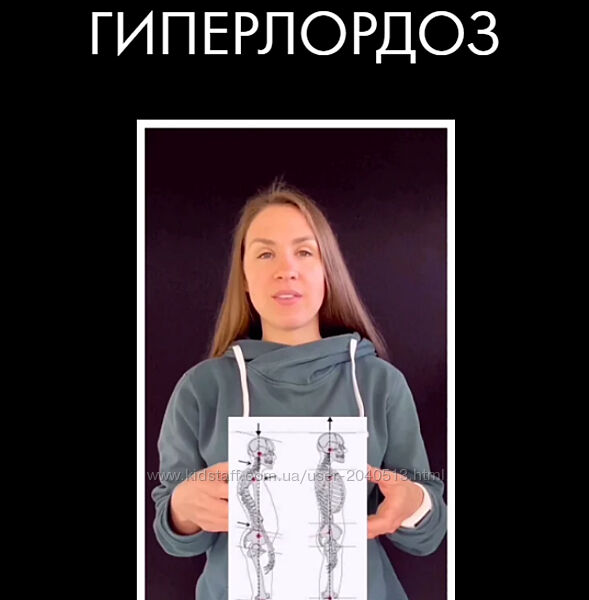 Христина Жарикова - Гиперлордоз. Полный курс