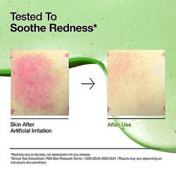 Сироватка з азелаїновою кислотою Anua Azelaic Acid 10 Hyaluron Redness Soothing Serum 30 ml